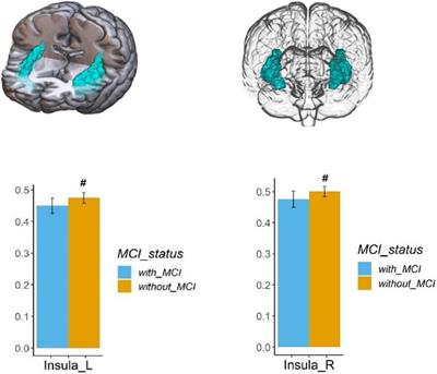 Effects of Chronic Hypoxic Environment on Cognitive Function and Neuroimaging Measures in a High-Altitude Population